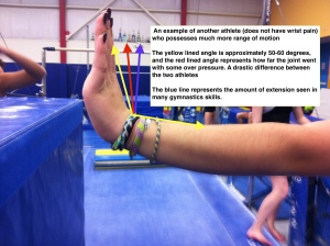 More Normal Wrist Extension Range of Motion 