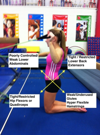 Possible Contributing Factors To Resting Anterior Tilt Posture